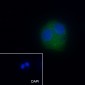 ALDH1L1 Recombinant Rabbit mAb